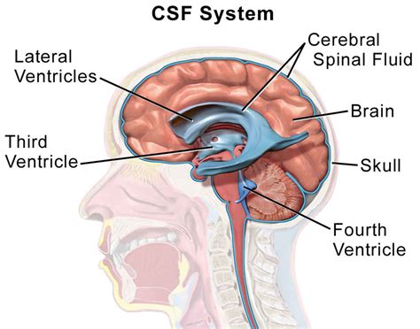 csf drop test|brain scan for csf leak.